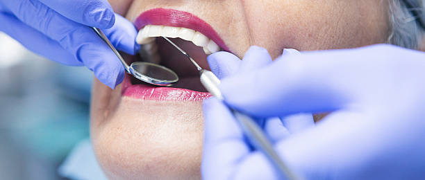 Best Emergency Wisdom Teeth Removal in New Hampton, IA